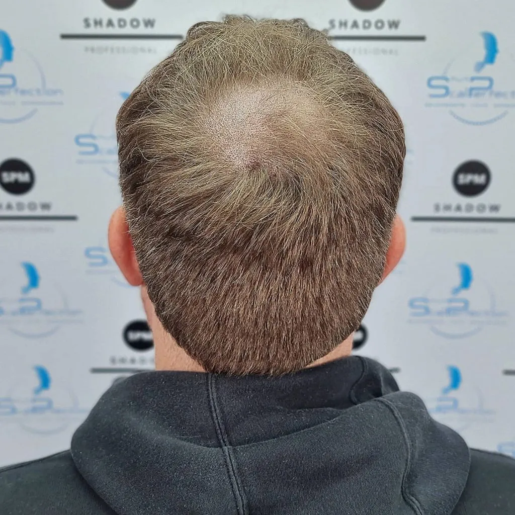 IMG_20211204_190904_555-1024x1024