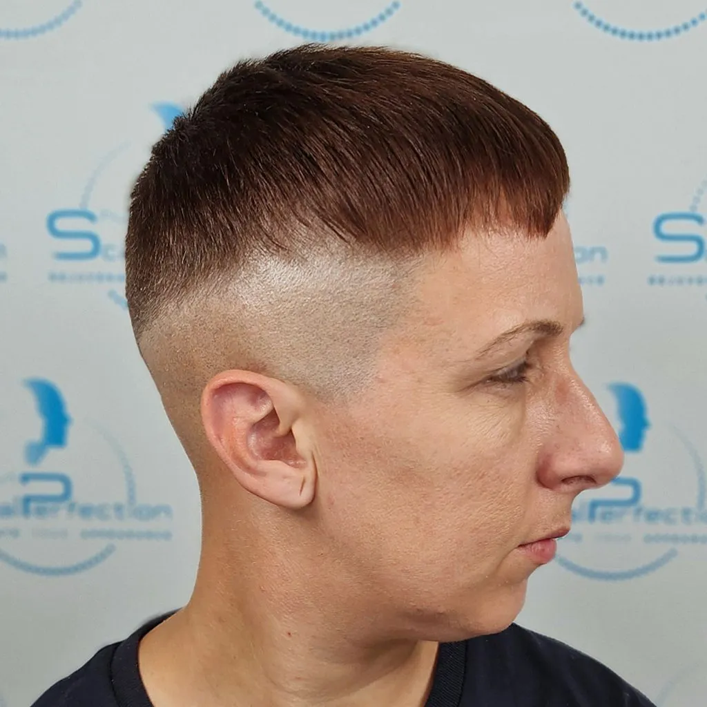 after-smp-1-1-1024x1024