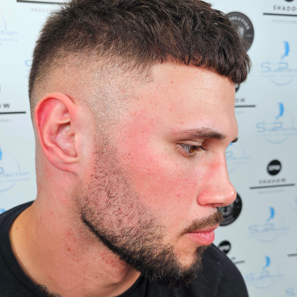 Facial Micropigmentation